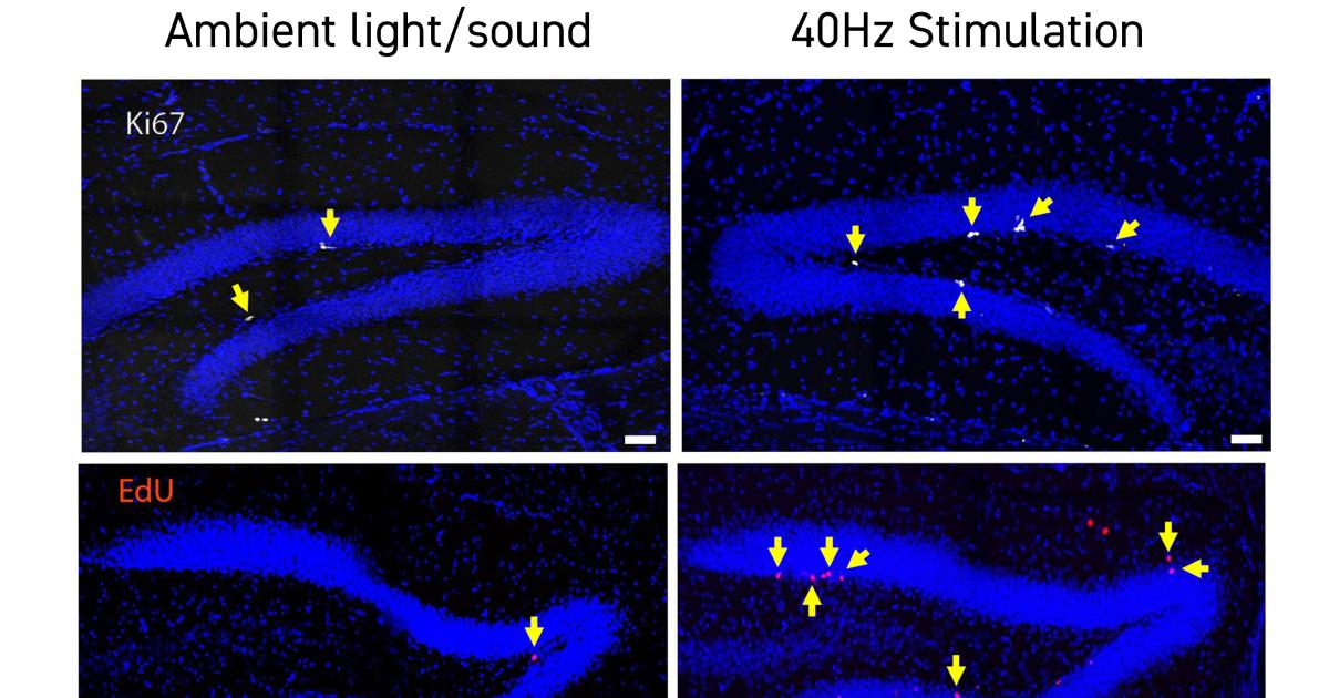 BRAIN ON 電気刺激デバイス　脳波誘導音源 BRAIN ON 電気刺激デバイス 脳波誘導音源